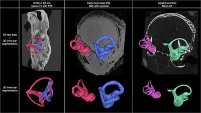 Multimodal Atlas of the Murine Inner Ear: From Embryo to Adult